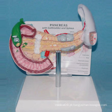 Modelo de cálculos biliares médicos e anatômicos do baço e pâncreas (R100207)